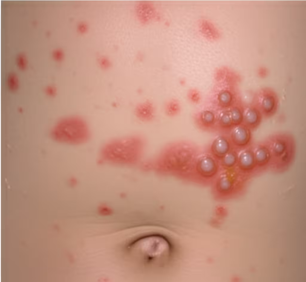 undefined A medical illustrati